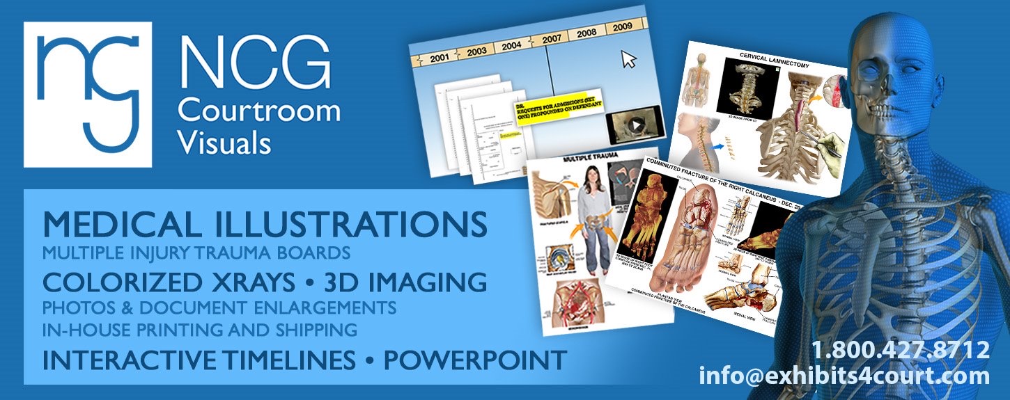 NCG Courtroom Visuals banner with medical boards, colorized X-rays, and a 3D skeleton